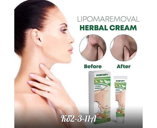 МАЗЬ ДЛЯ ОТШЕЛУШИВАНИЯ ОПУХОЛЕЙ LIPOMA, код 50162907